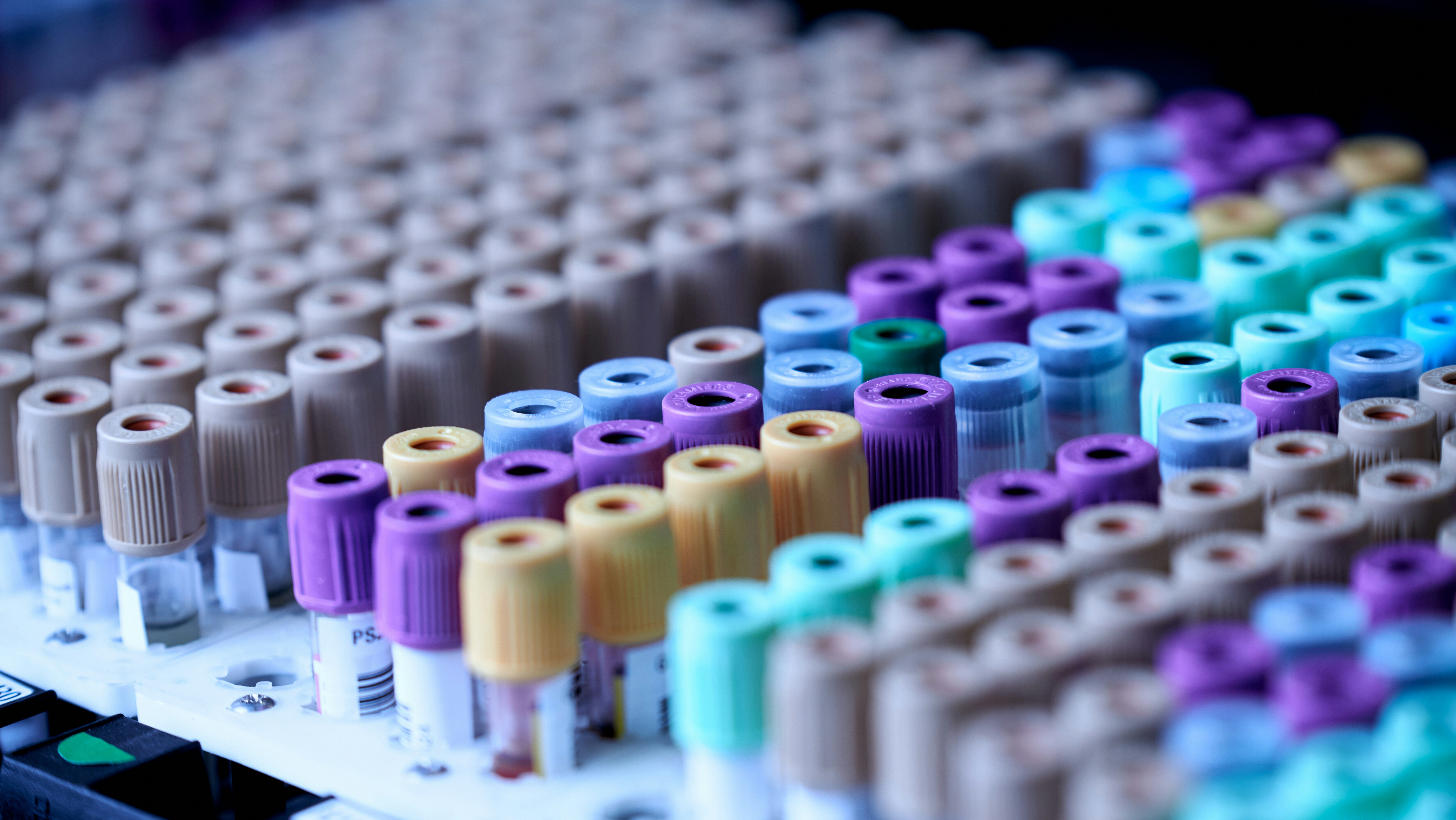 dozens of rows of blood test vials